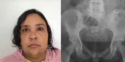 Mulher de 37 anos fingia ter 12 anos e foi acolhida em Joinville