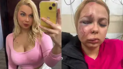 Mulher é espancada em Metrô de SP e sofre múltiplas fraturas