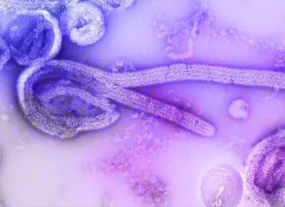 SP descarta 2º caso suspeito de ebola em 2025