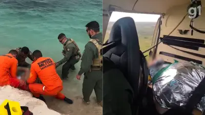 Turista de SP perde movimentos após mergulho em lagoa nos Lençóis Maranhenses