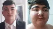 Adolescente de 16 anos descobre tumor raro após ganhar 43 kg em meses