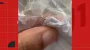 Agulha encontrada em carne no RU da Ufes em Vitória