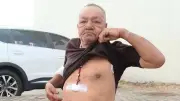Aposentado é esfaqueado na barriga e no braço na Serra