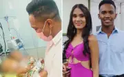 Bebês siameses unidos pelo abdômen morrem em Goiás