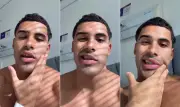 Cantor Nilo tem paralisia facial e anuncia pausa na carreira