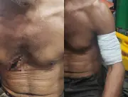 Caseiro é atacado a facão em garimpo em Alto Alegre, RR