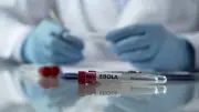 Caso suspeito de ebola investigado no RS; homem esteve em Uganda