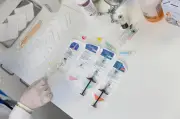 Ácido hialurônico apoia redesignação facial de pessoas trans