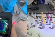 Esteticista presa por procedimentos irregulares em clínica clandestina em Santos