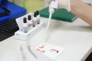 Exame de sangue detecta câncer precoce em estudo com 142 mil pessoas