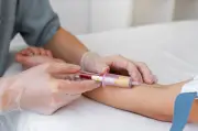 Exame de sangue prevê câncer de pulmão até 5 anos antes