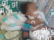 Família de bebê com crises convulsivas luta por diagnóstico no Acre