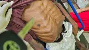 Filha é presa suspeita de maus-tratos que mataram pai idoso no Pará