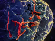 Fiocruz investiga suspeita de Ebola no RS após viagem à Uganda