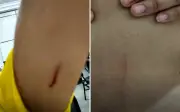 Funcionária é atacada com tesoura por colega após denunciar descumprimento de regra