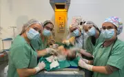 Gêmeos siameses unidos pelo abdômen morrem após infecção em Goiânia