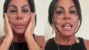 Gretchen faz fios de sustentação e reacende debate sobre lifting facial