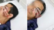 Homem é espancado por seis pessoas em ataque homofóbico em Florianópolis