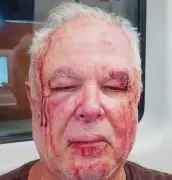 Idoso é agredido em Copacabana por motivação política