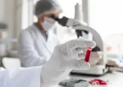 Imunoterapia reduz em 71% risco de progressão do mieloma múltiplo