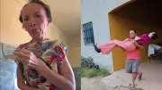 Influenciadora com doença rara que ossifica músculos viraliza na web