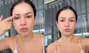 Juliette atualiza estado de saúde após inflamação no fígado: 'Cara toda inchada'