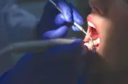 Justiça proíbe dentista de fazer rinoplastia e blefaroplastia