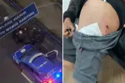 Motociclista baleado por guarda em São Vicente contesta versão da GCM