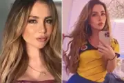 Mulher morre em cirurgia para retirar preenchimento tóxico nos glúteos na Colômbia