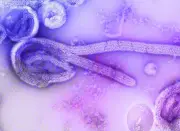 OMS: pânico desnecessário após 1º caso de Ebola na França