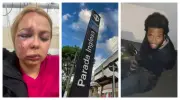 Pai critica soltura de agressor após filha ser espancada no Metrô de SP