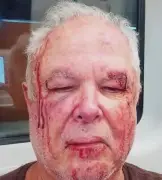 Polícia investiga agressão a idoso do PT em Copacabana