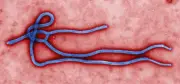 SP descarta segunda suspeita de ebola em 2023