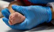 Teste do pezinho completa 25 anos com desafio de acesso à versão ampliada