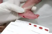 Teste do pezinho: DF e MG são referência na triagem neonatal no Brasil