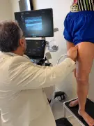 Tratamento de varizes: ultrassom essencial para diagnóstico preciso