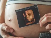 Ultrassonografia obstétrica avança no diagnóstico pré-natal com IA