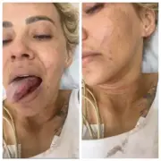 Vítima de espancamento grava vídeo do hospital e relata agressão do ex-noivo