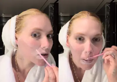 Dermaplaning: técnica viral de Virginia Fonseca gera dúvidas sobre riscos