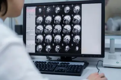 Estudo inédito revela mecanismos cerebrais do TOC e abre caminho para novos tratamentos