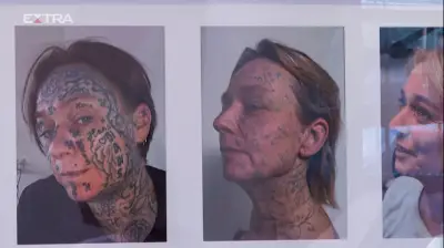 Holandesa remove 250 tatuagens feitas à força por ex-namorado abusivo
