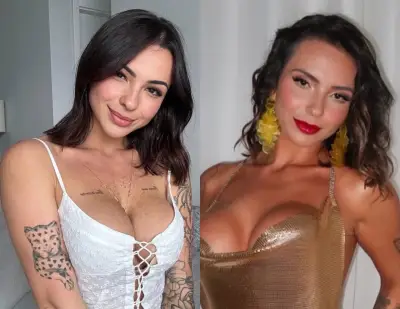 Influenciadora não se reconhecia após botox: 'Parecia mais velha'
