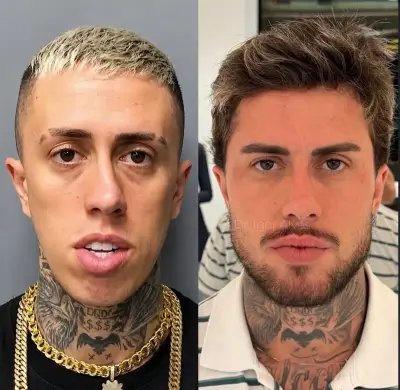MC Daniel impressiona com antes e depois de procedimentos estéticos