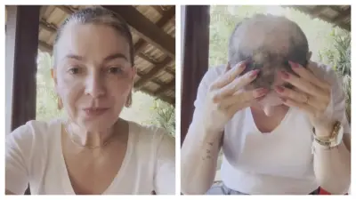 Mãe de Lucas Lucco enfrenta nova crise de alopecia areata