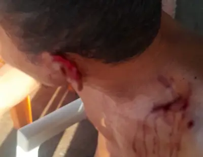 Mulher morde e arranca parte da orelha do marido em bar em Boa Vista