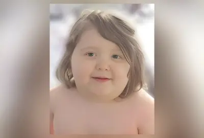 Pais de menino de 7 anos com 116 kg passarão por avaliação mental nos EUA