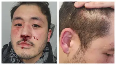 Professor espancado em metrô de SP alega homofobia e omissão