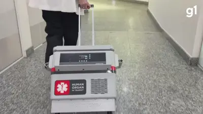 Tecnologia gaúcha dobra tempo seguro para transplantes de coração