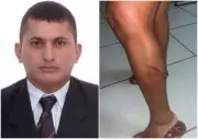 Advogado denunciado por agredir ex-mulher com pedaço de madeira em Boa Vista