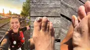 Brasileira mostra pés após ultramaratona de 139 km no Canadá; veja
